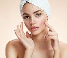 Do laser acne treatments work for cystic acne?