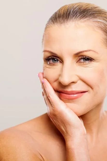 Bellafill® at Skin Med Spa