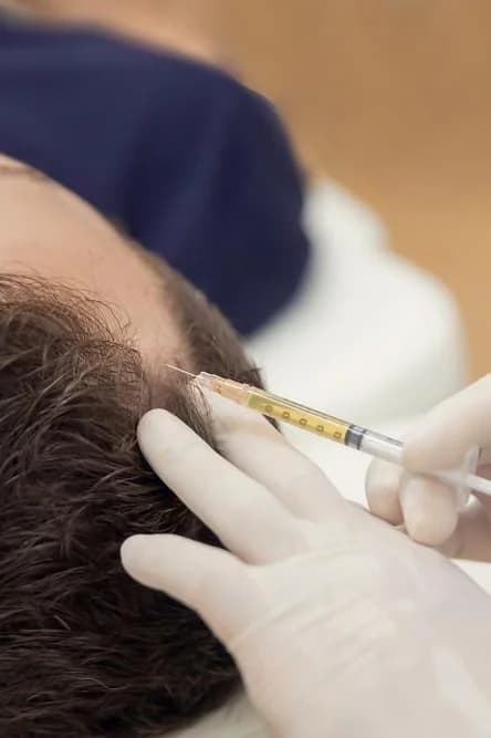 Hair Restoration — Body at Skin Med Spa