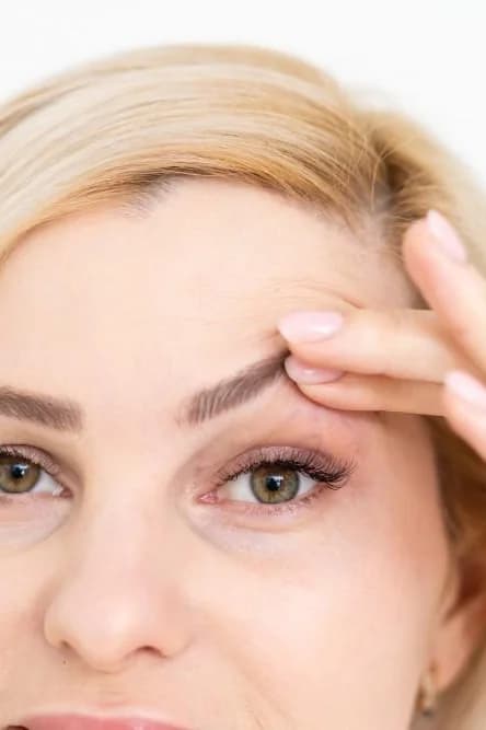 Plasma Pen — Laser at Skin Med Spa