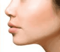 How many Kybella sessions do I need?