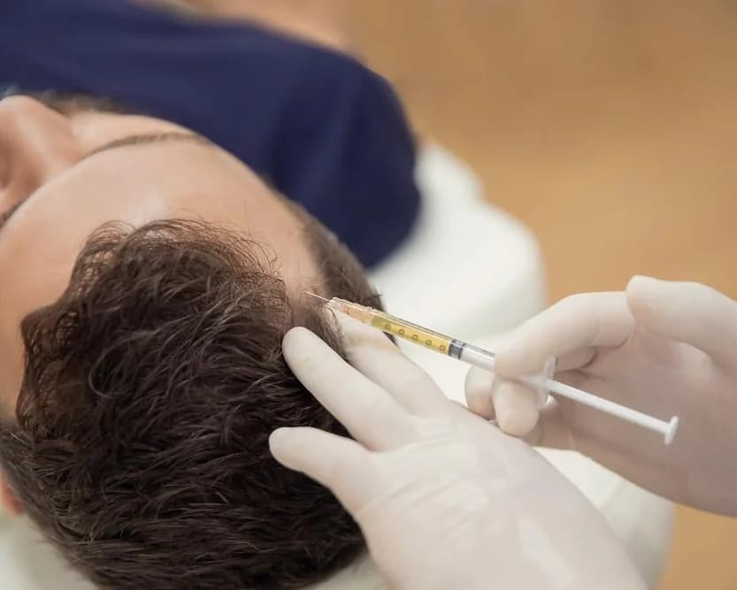 Provider placing PRP injections across a patient's scalp